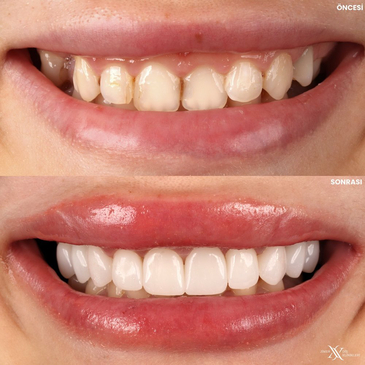 Slider image (4) Jimer Dental Clinics